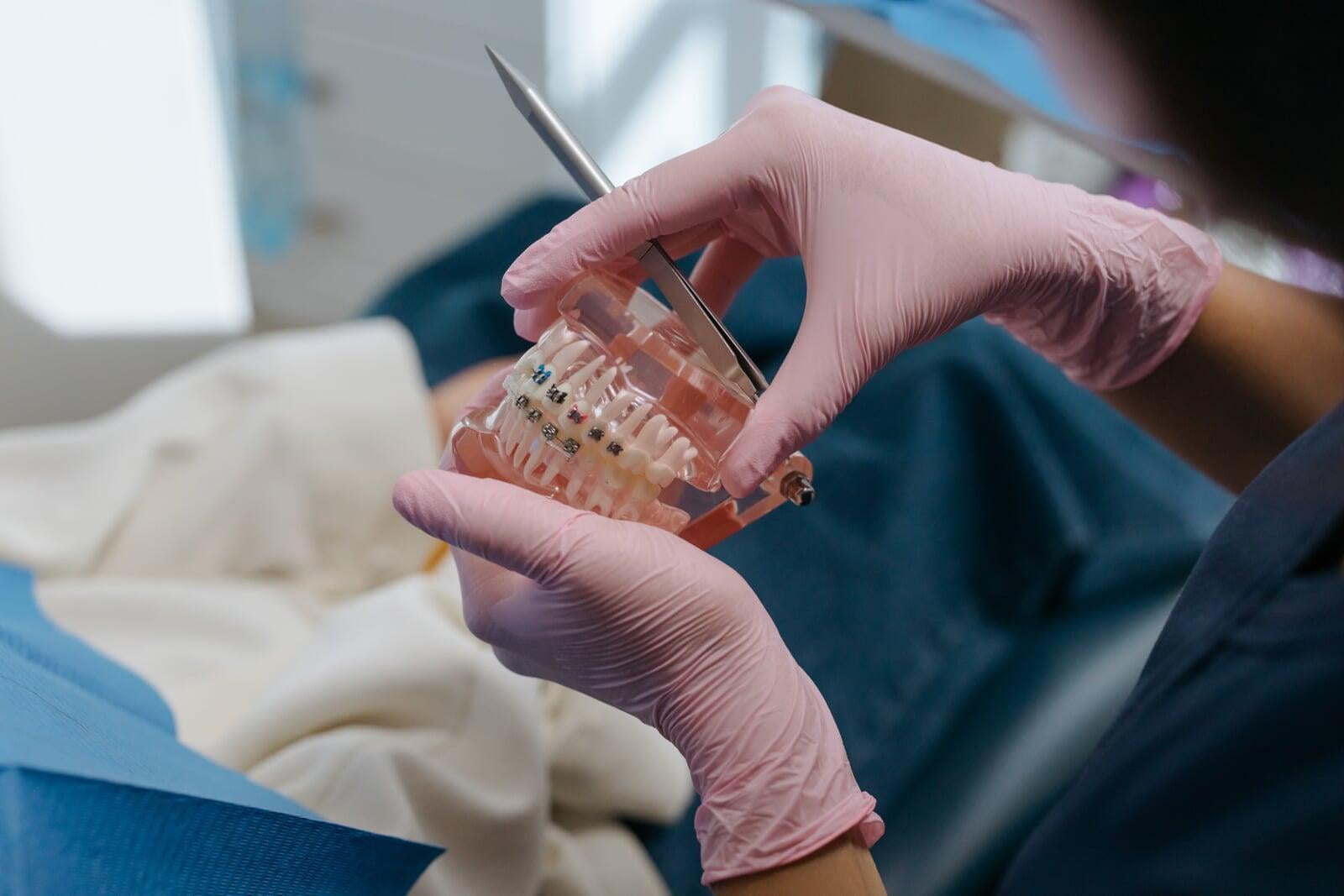 Rehabilitación Neuro-oclusal: Un Enfoque Integral para la Salud Bucofacial