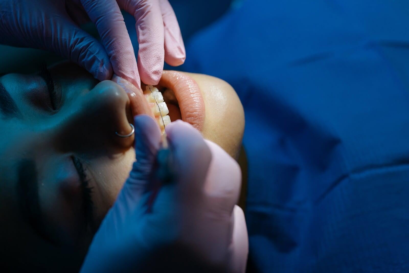 Los instrumentos necesarios para el doblaje de alambre en ortodoncia y ortopedia craneofacial, así como sus características, manejo y aplicaciones