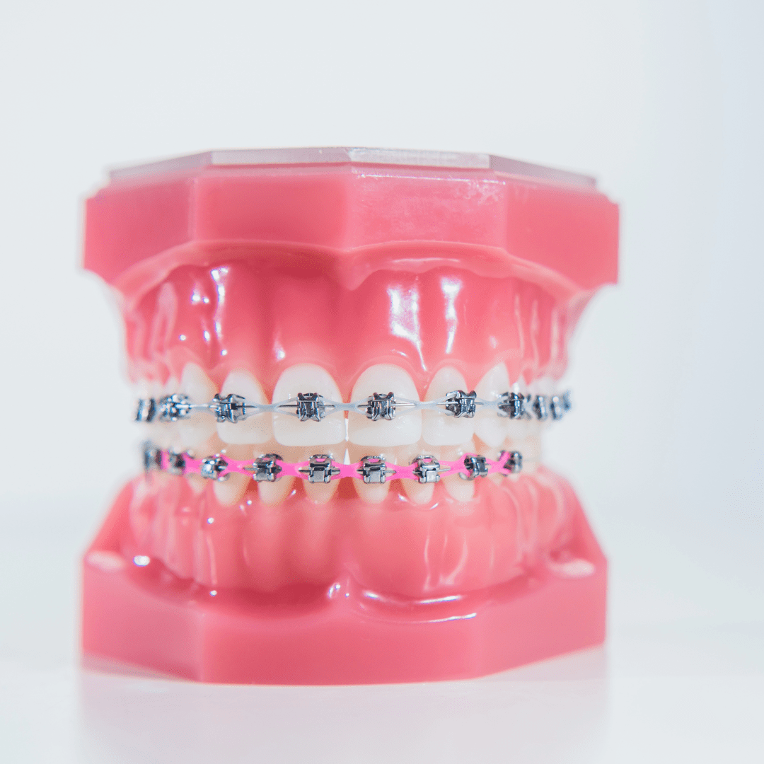 Ortodoncia: La Ciencia de las Sonrisas Perfectas