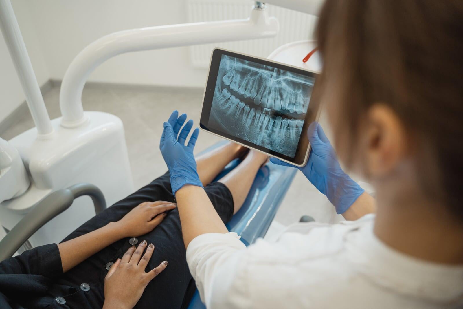 La Radiología en la Odontología Pediátrica